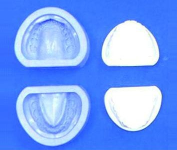 標準牙頜硅橡膠陰模 標準牙頜硅橡膠陰模